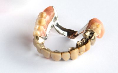 Warum der Verkauf von Zahngold sinnvoll ist